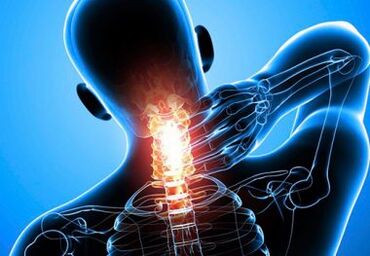 dolor de cuello intenso con osteocondrosis avanzada