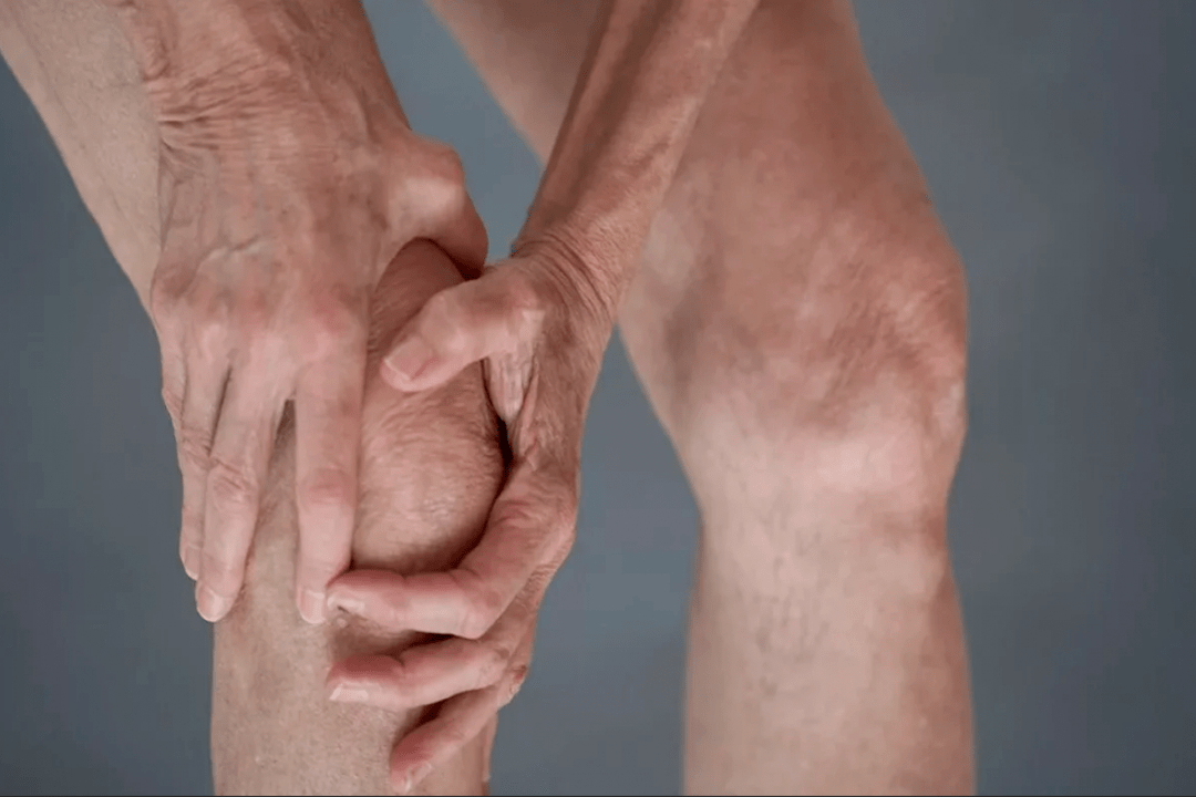 El dolor articular puede ser la causa de artrosis o artritis. 