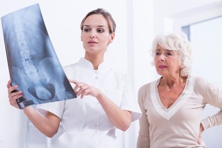 El examen de rayos X es una forma informativa de diagnosticar la osteocondrosis de la columna vertebral. 