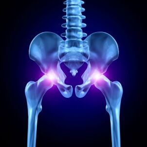 El dolor en las articulaciones de la cadera puede ser agudo, doloroso o crónico. 