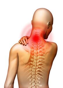 El dolor es el síntoma principal de la osteocondrosis cervical.