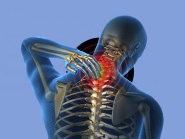 A una persona con osteocondrosis de la columna cervical le molesta el dolor de cuello.