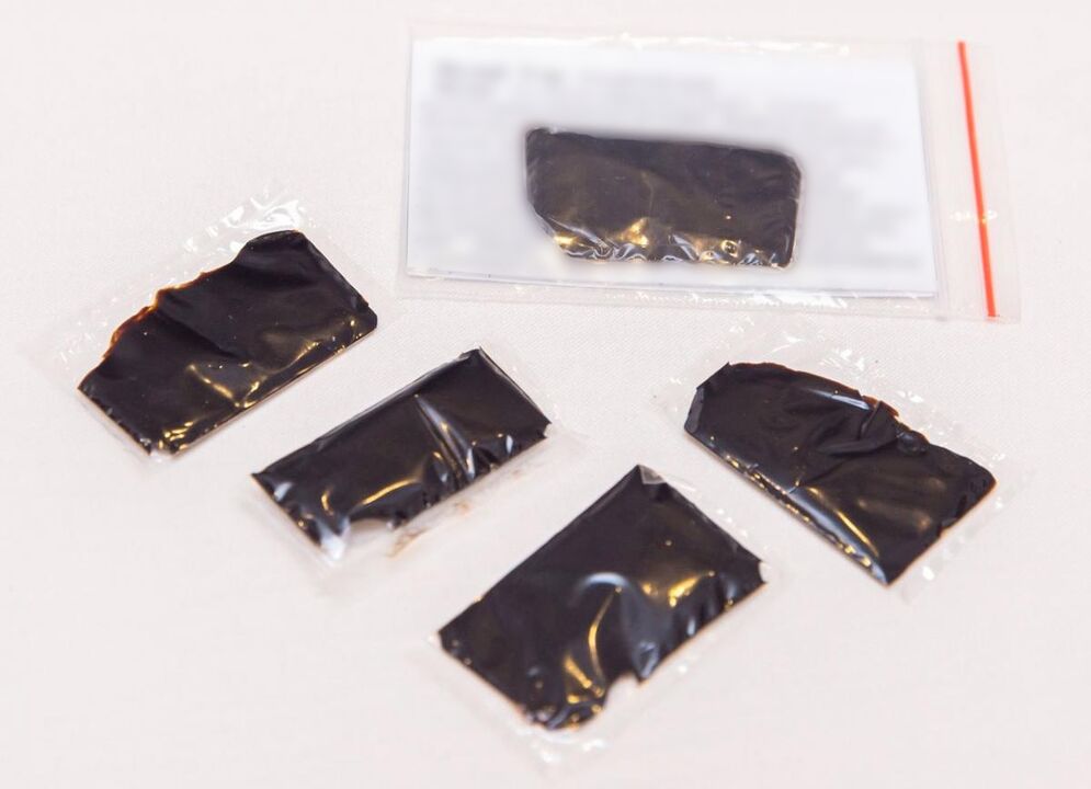 Shilajit es un remedio eficaz para el tratamiento de la osteocondrosis cervical en casa.