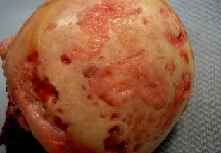 Afectado artrosis) el cartílago superficie